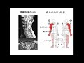 脊髄刺激療法（SCS）療養中の感想（脊椎手術後疼痛症候群）▶動画